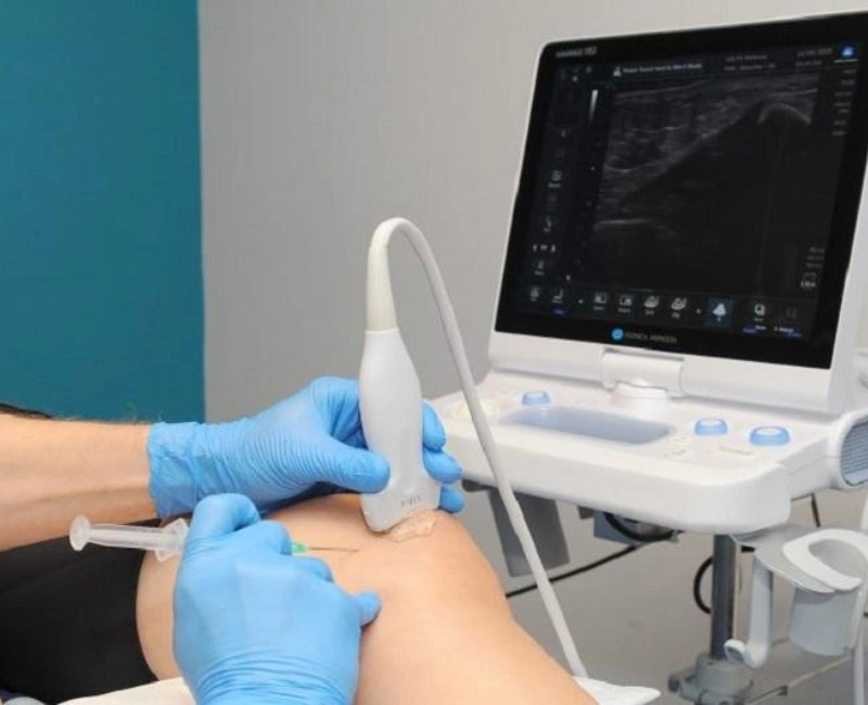 Physiotherapist performing an ultrasound guided injection at The Physiotherapy Centre